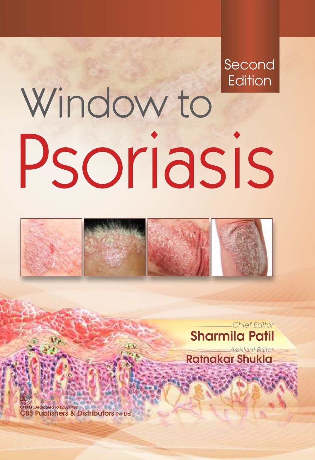 Window To Psoriasis 2Ed (Hb 2022)