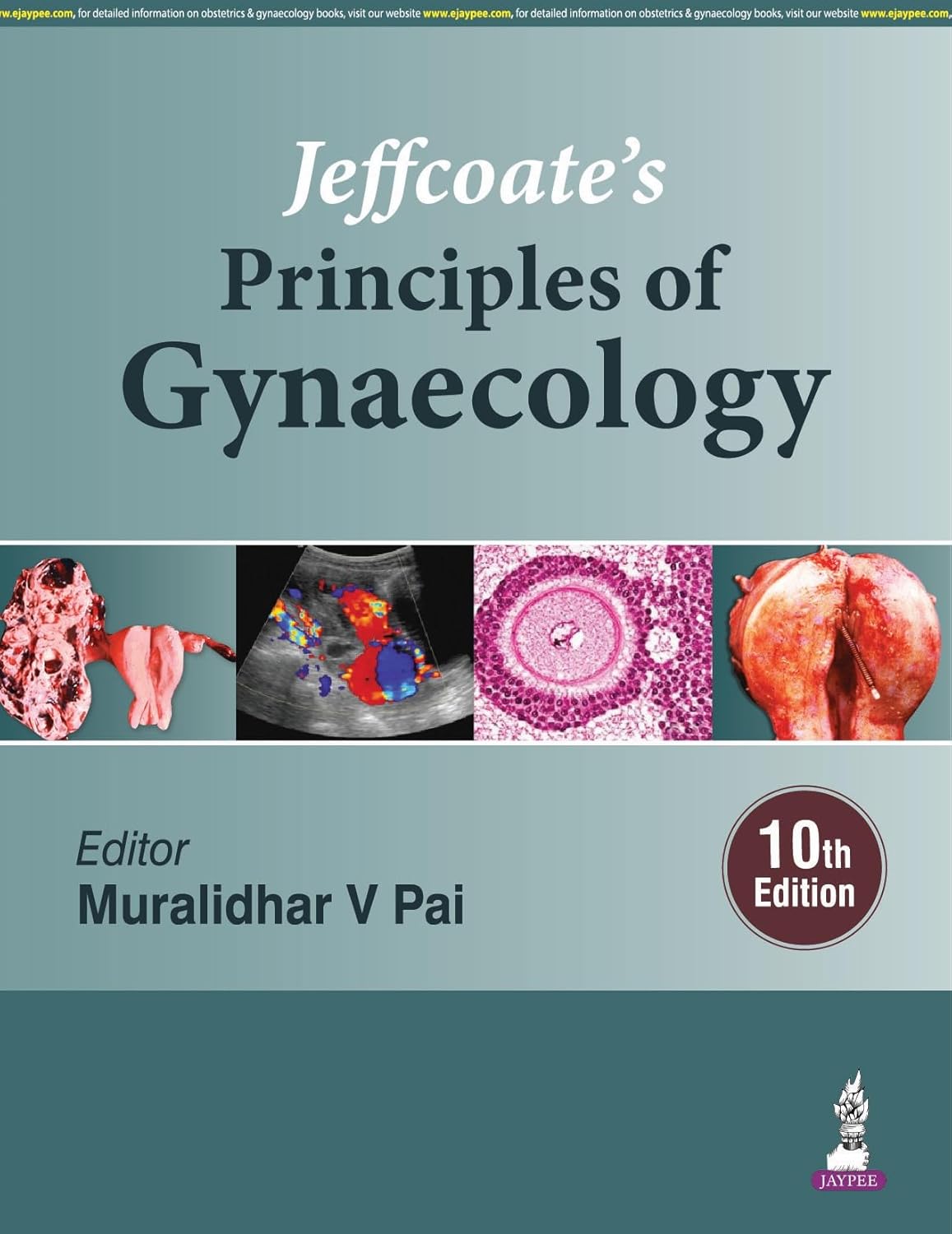 JEFFCOATE'S PRINCIPLES OF GYNAECOLOGY