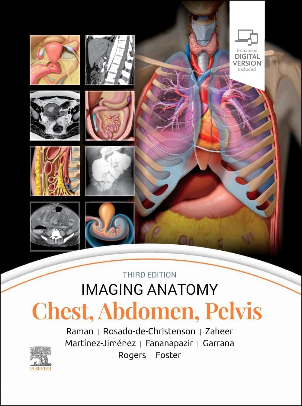 Imaging anatomy chest abdomen pelvis with access code 3ed (hb 2024)