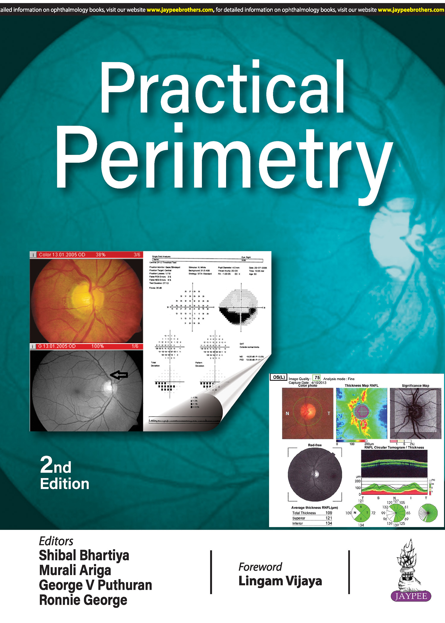 PRACTICAL PERIMETRY 2ND EDITION 2024