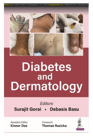 Diabetes and Dermatology 1st 2023