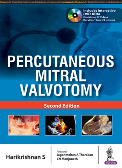 Percutaneous Mitral Valvotomy With Dvd-Rom