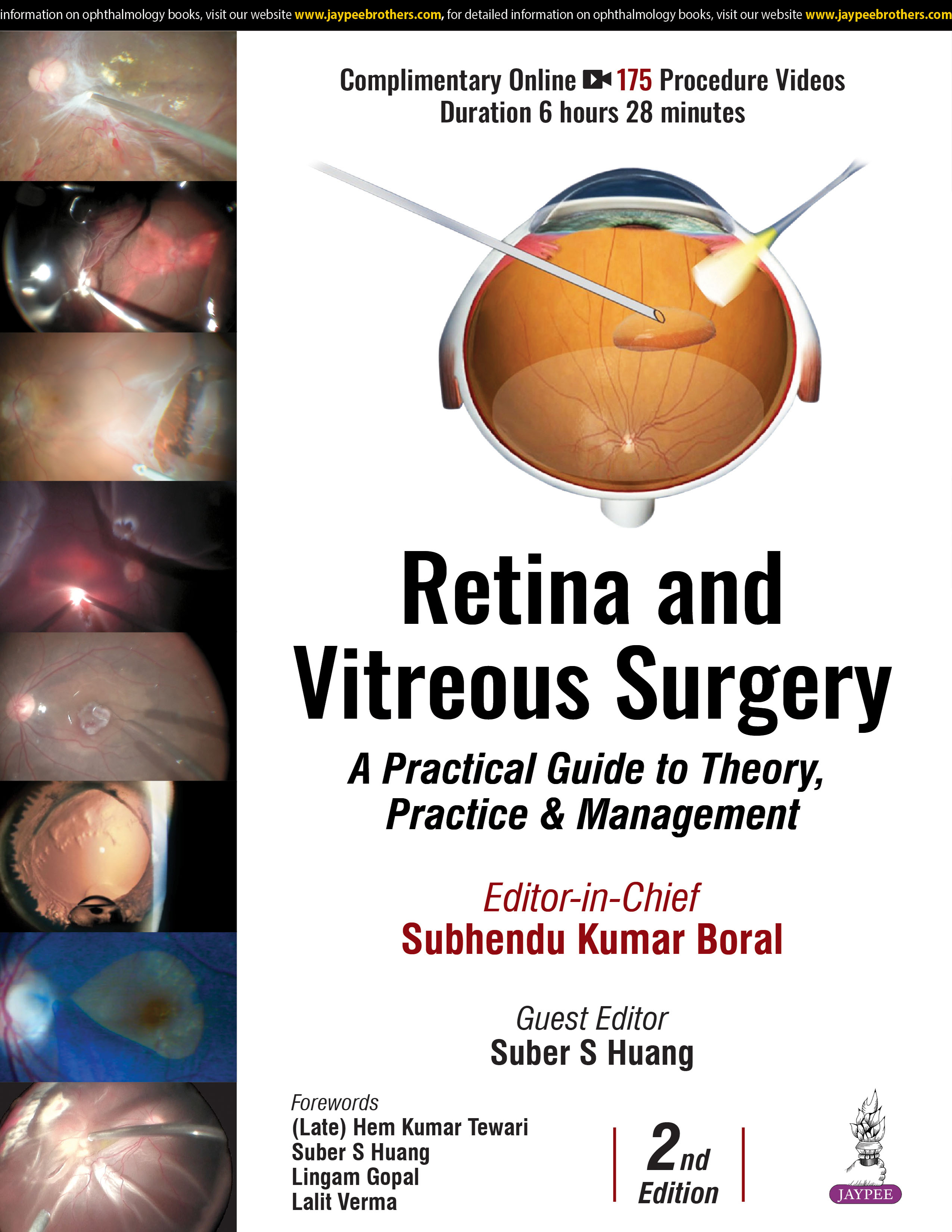Retina And Vitreous Surgery : A Practical Guide To Theory, Practice & Management