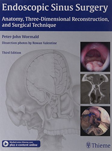 Endoscopic Sinus Surgery 3rd Edition(Indian Reprin