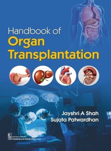 Cover of Handbook Of Organ Transplantation