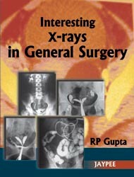 Interesting X-Rays In General Surgery
