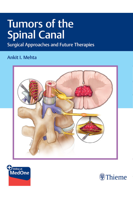 Tumors of the Spinal Canal 1st Edition 2023