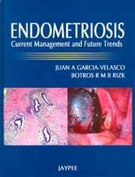 Endometriosis:Current Managment And Future Trends