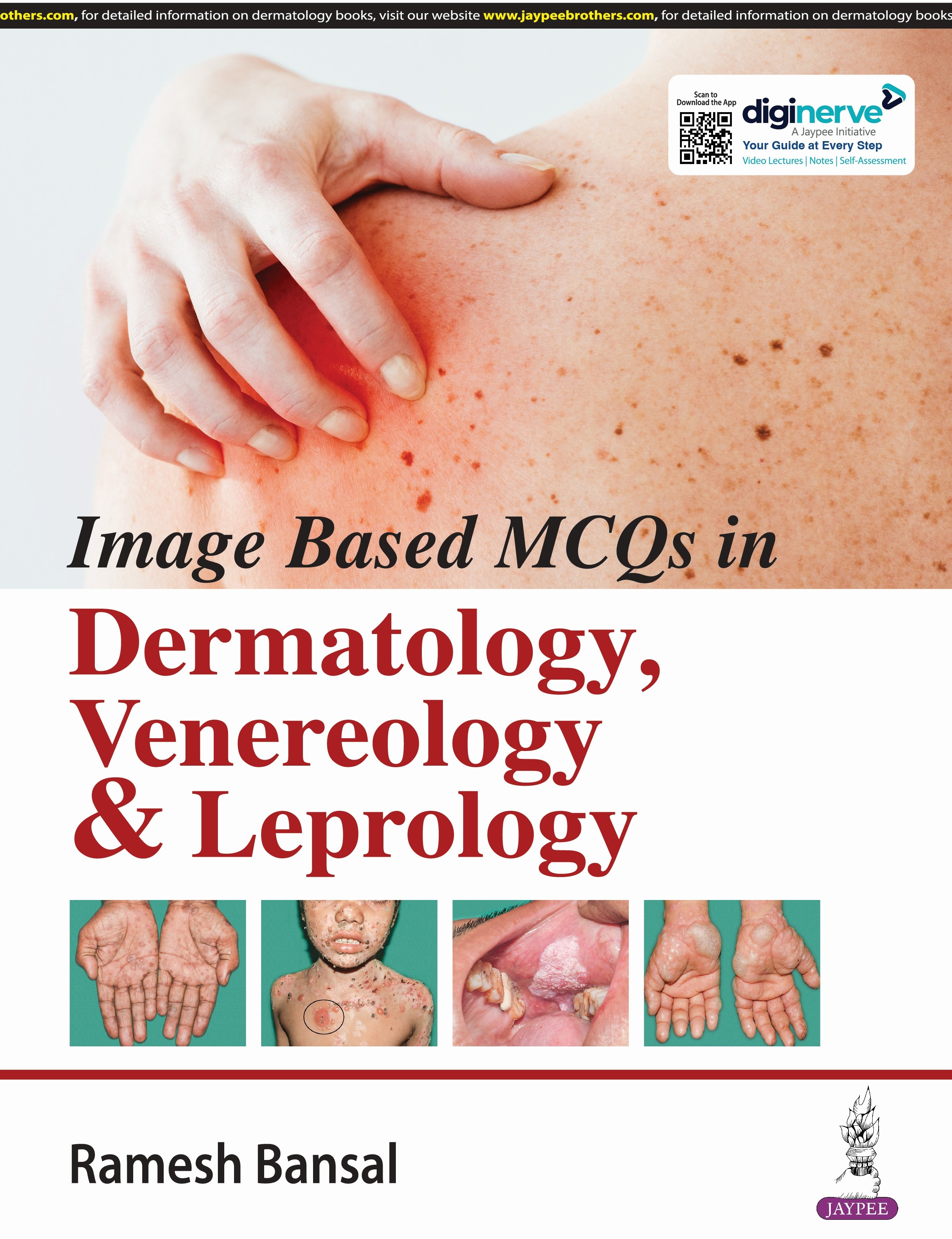 IMAGE BASED MCQ'S IN DERMATOLOGY, VENEREOLOGY & LEPROLOGY