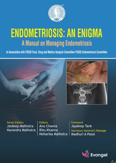 FOGSI ENDOMETRIOSIS An Enigma