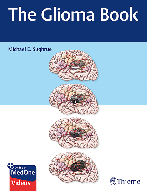 The Glioma Book 1st Edition 2009