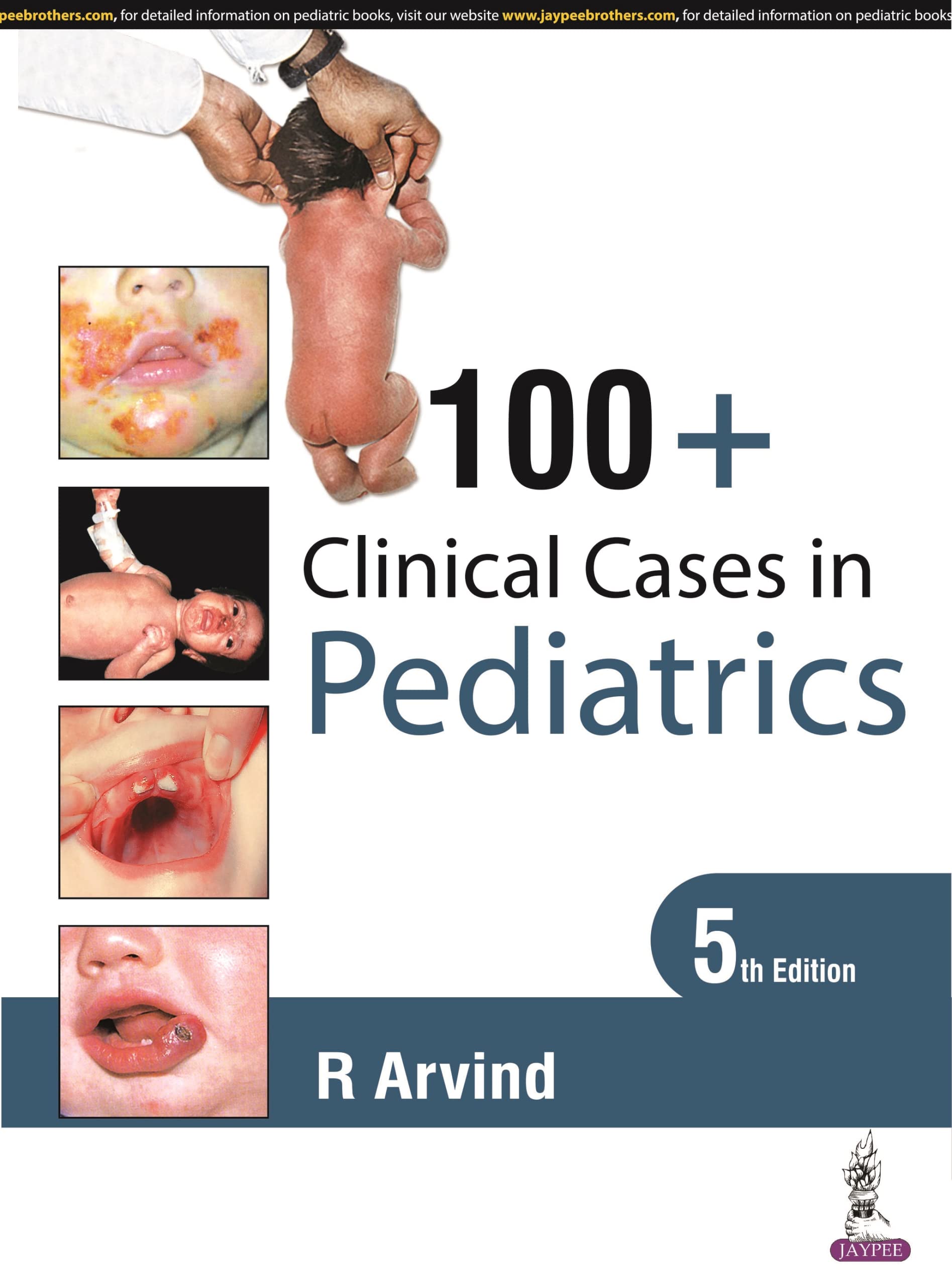 100 + Clincial Cases In Pediatrics