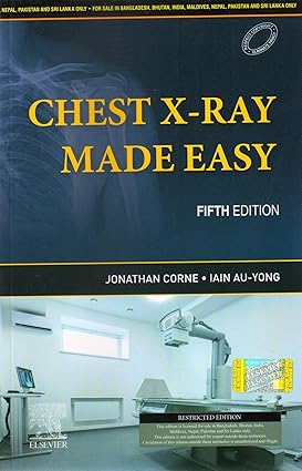 Chest X Ray Made Easy 5Ed (Pb 2023)