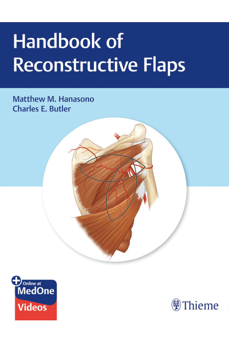 Handbook Of Reconstructive Flaps