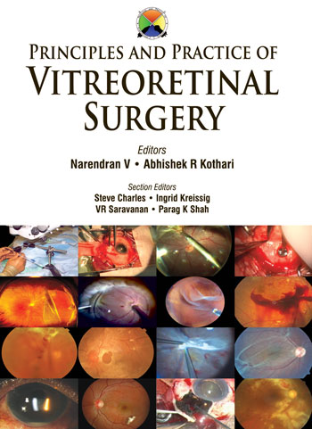 Principles And Practice Of Vitreoretinal Surgery