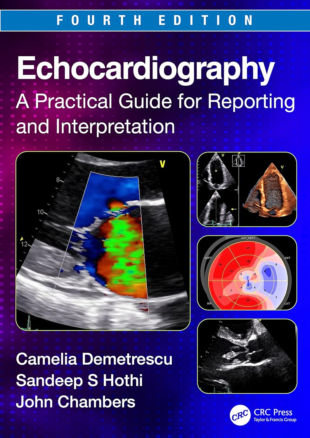 Echocardiography A Practical Guide For Reporting And Interpretation 4Ed (Pb 2024)