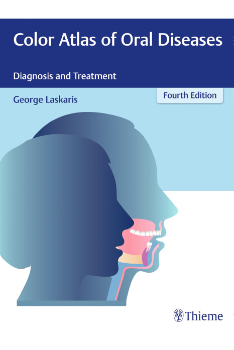Color Atlas Of Oral Diseases Diagnosis And Treatment