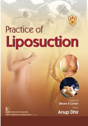 Practice Of Liposuction (Hb 2024)