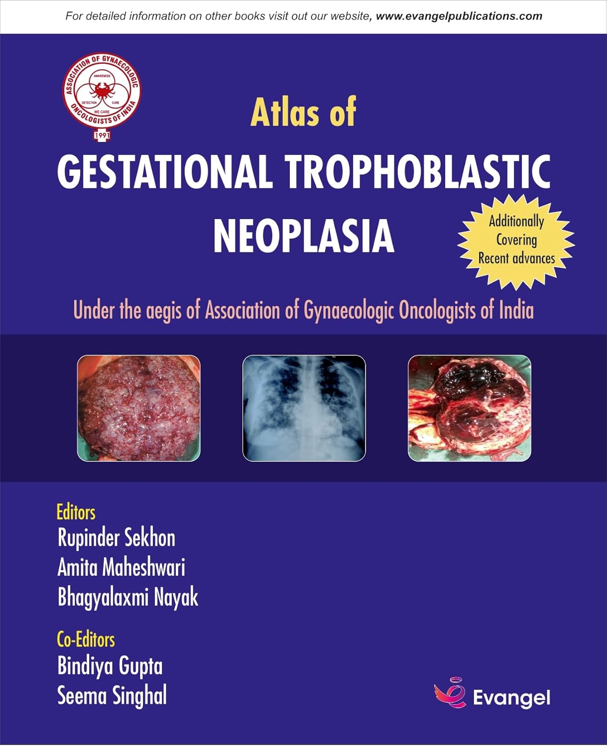 AGOI Atlas of GESTATIONAL TROPHOBLASTIC NEOPLASIA