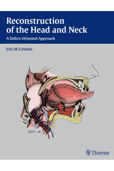 Reconstruction Of The Head And Neck A Defect-Oriented Approach