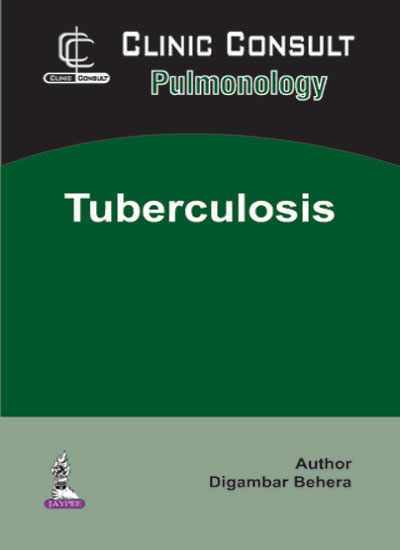 Clinic Consult Pulmonology Tuberculosis