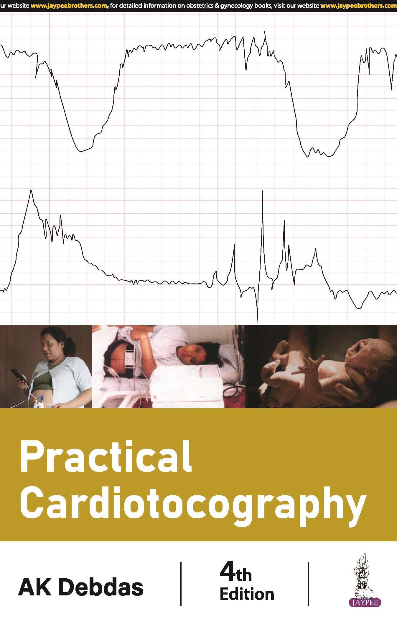 PRACTICAL CARDIOTOCOGRAPHY 4TH 2024
