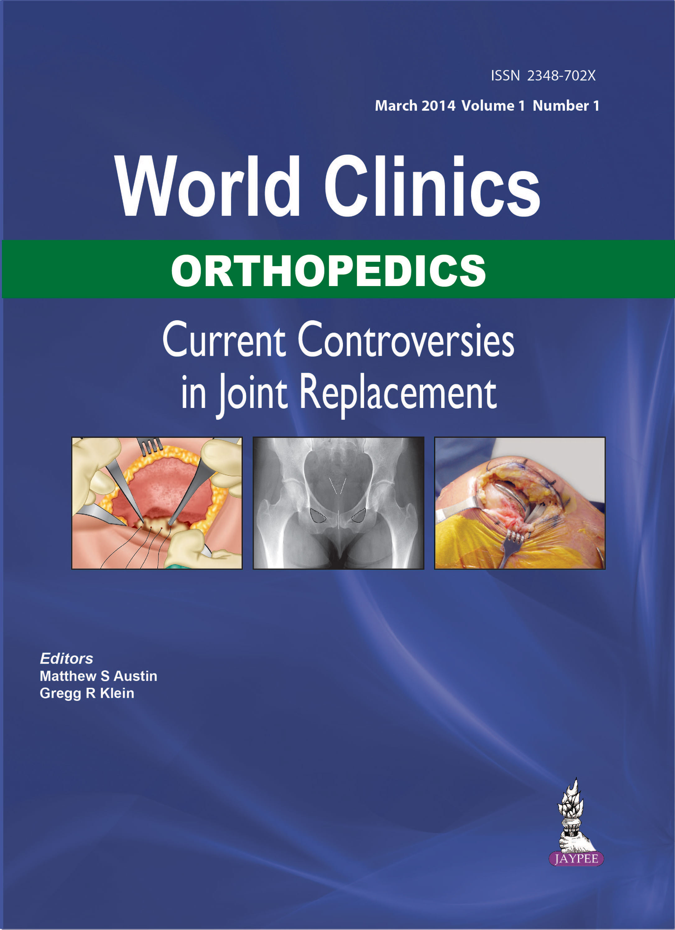 World Clinics Orthopedics Current Controversies In Joint Replacement Mar.2014,Vol.1,No.1