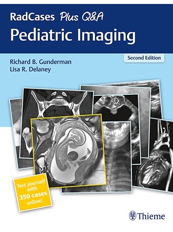 Radcases Plus Q And A Pediatric Imaging 2Ed (Pb 2019)