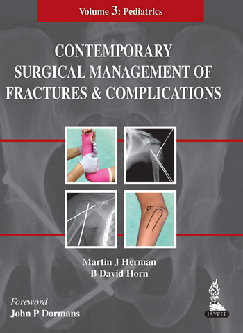 Contemporary Surgical Management Of Fractures And Complications Vol.3 Pediatrics