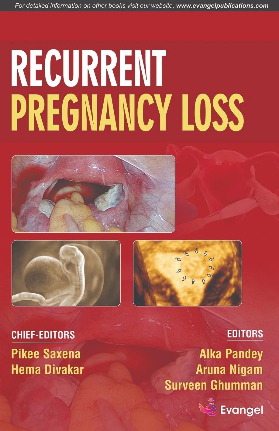 FOGSI FOCUS On Recurrent Pregnancy Loss