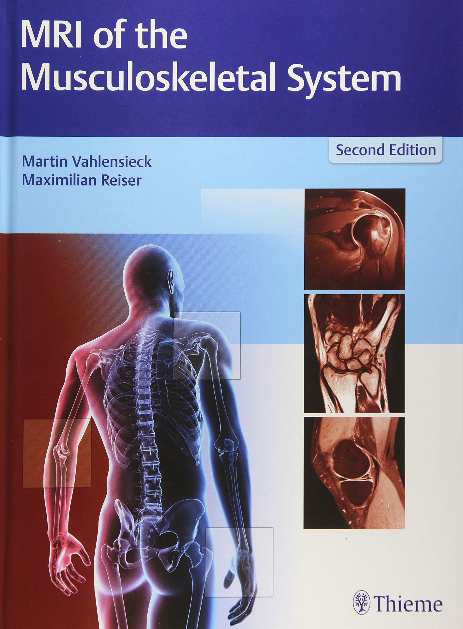 Mri Of The Musculoskeletal System