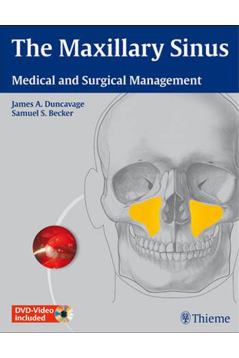 The Maxillary Sinus 1st Edition 2011