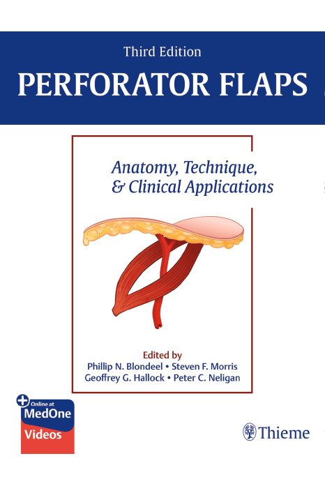 Perforator Flaps Anatomy Technique And Clinical Applications With Access Code 3Ed (Hb 2024)