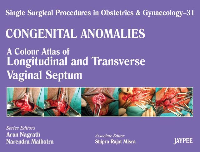 Single Surgical Procedures In Obstetrics And Gynecology-31 Congenital Anomalies: A.C.A.Of Longitudin