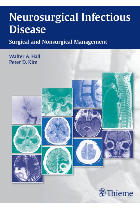 NEUROSURGICAL INFECTIOUS DISEASE 1st Edition 2013