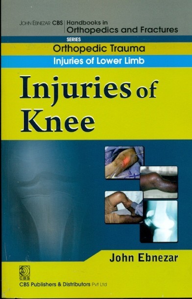 Injuries Of Knee (Handbook Of Orthopedics And Fractures Series Vol 15 Orthopedic Trauma Injuaries Of Lower Limb (2012)