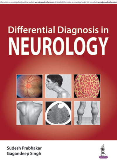 Differential Diagnosis In Neurology