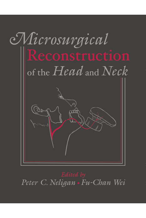 Microsurgical Reconstruction Of The Head And Neck