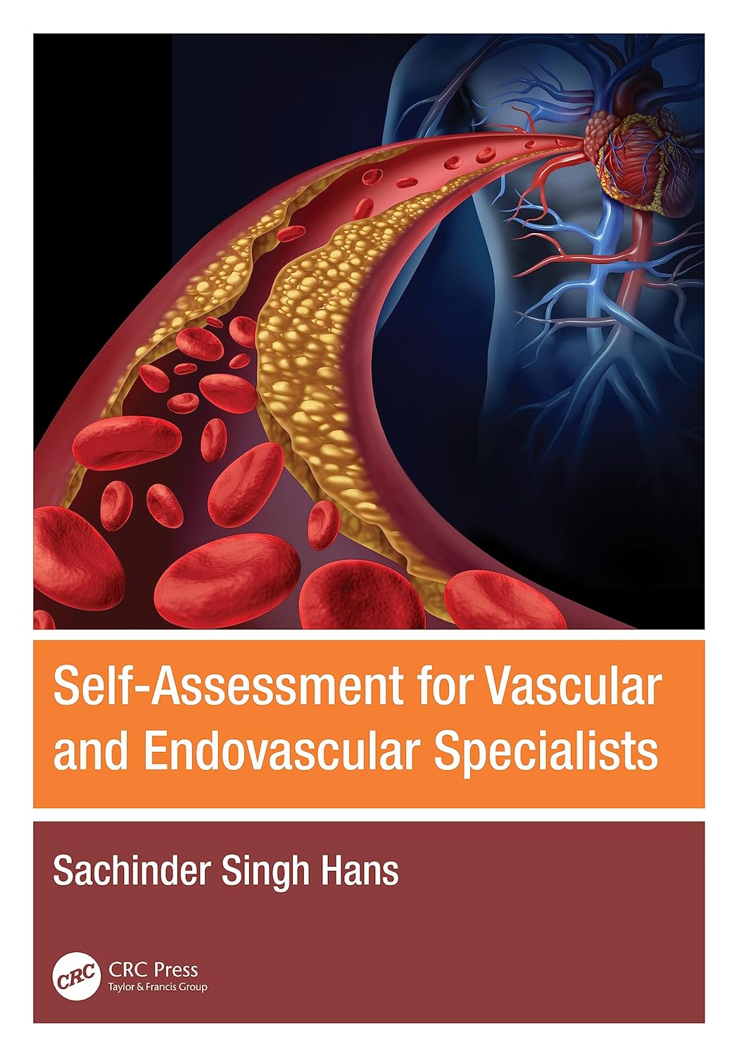 Self Assessment For Vascular And Endovascular Specialists (Pb 2024)