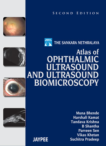 The Sankara Nethralaya Atlas Of Ophthalmic Ultrasound And Ultrasound Biomicroscopy