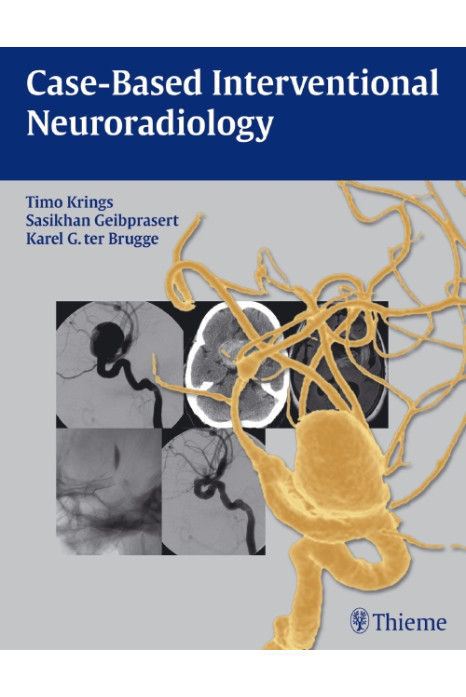 Case- Based Interventional Neuroradiology 1st Edition 2011