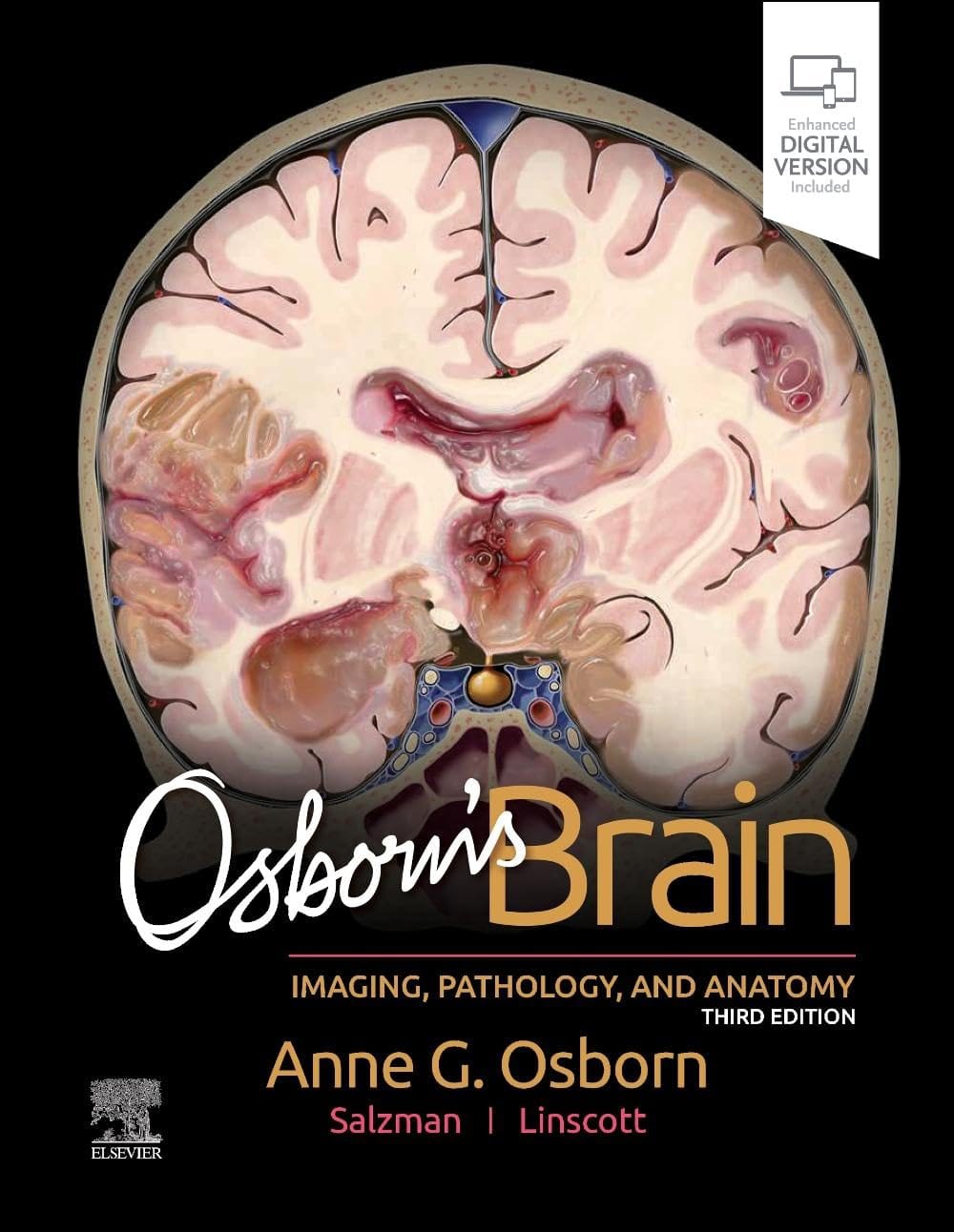 Osborns brain imaging pathology and anatomy with access code 3ed (hb 2024)