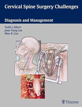 Cervical Spine Surgery Challenges 1st Edition 2008