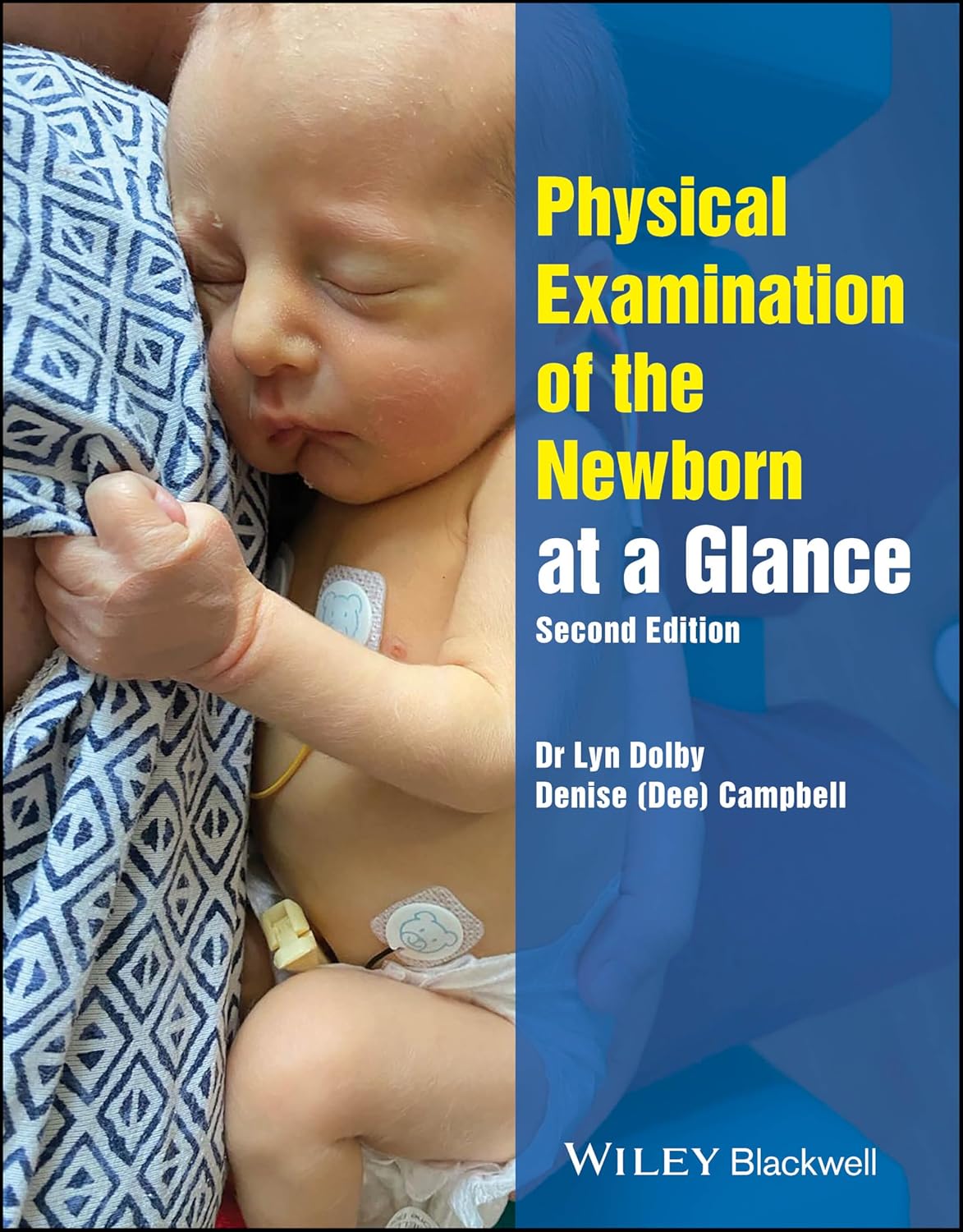 Physical Examination Of The Newborn At A Glance 2Ed (Pb 2025)