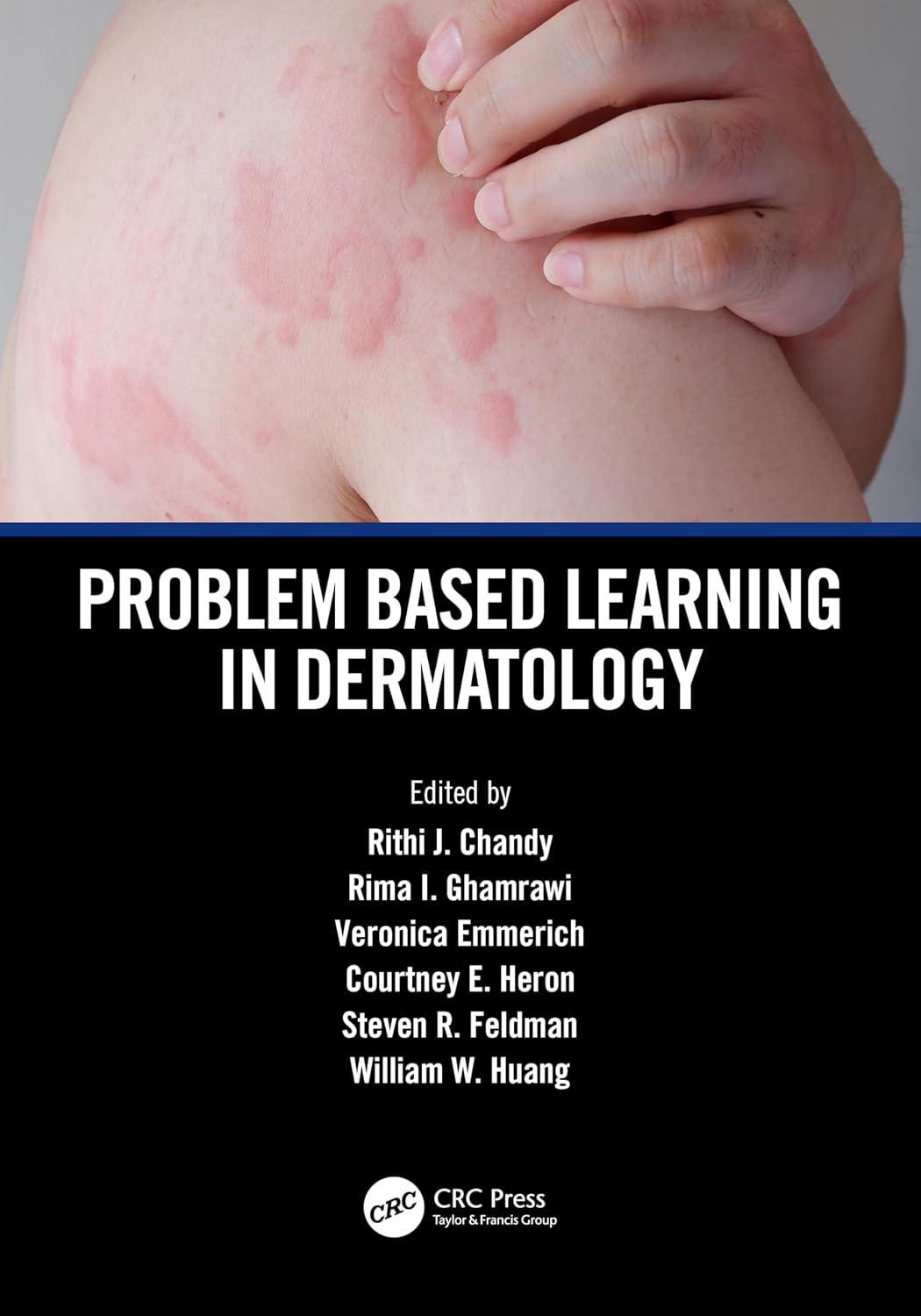Problem Based Learning In Dermatology (Pb 2025)