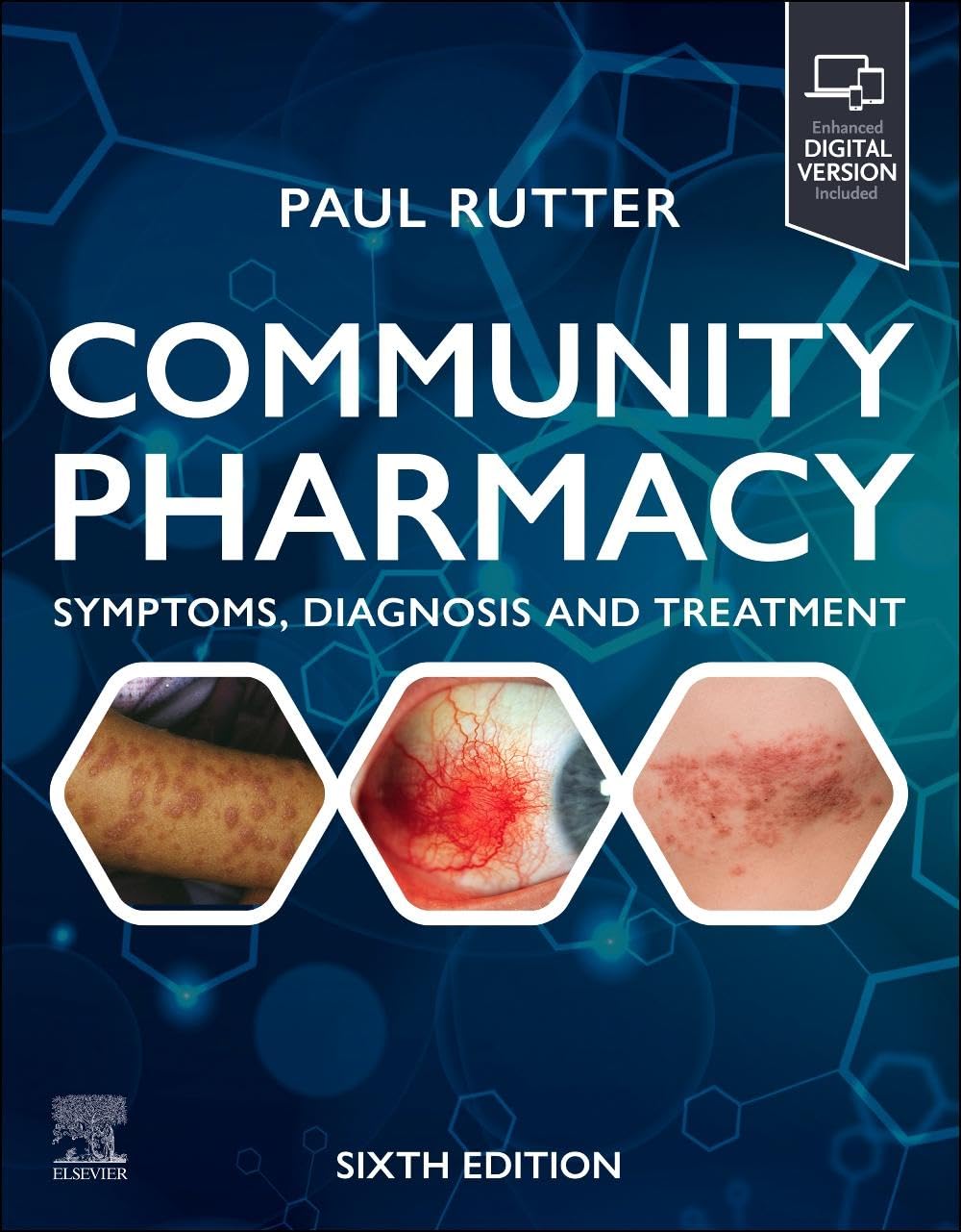 Community pharmacy symptoms diagnosis and treatment 6ed (pb 2025)