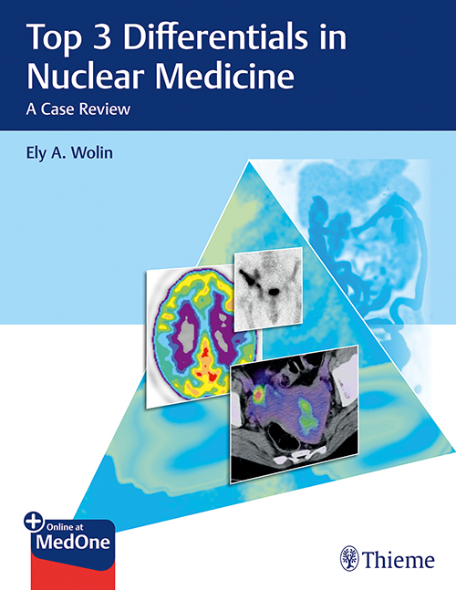 Top 3 Differentials In Nuclear Medicine A Case Review