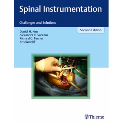 Spinal Instrumentation Challenges And Solutions 2Ed (Hb 2018)