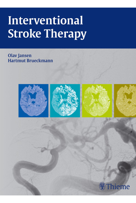 Interventional Stroke Therapy