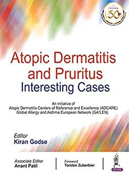 Atopic Dermatitis And Pruritus Interesting Cases